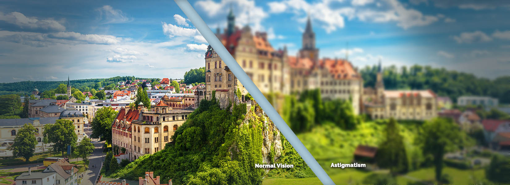 Astigmatism Treatment in Midtown