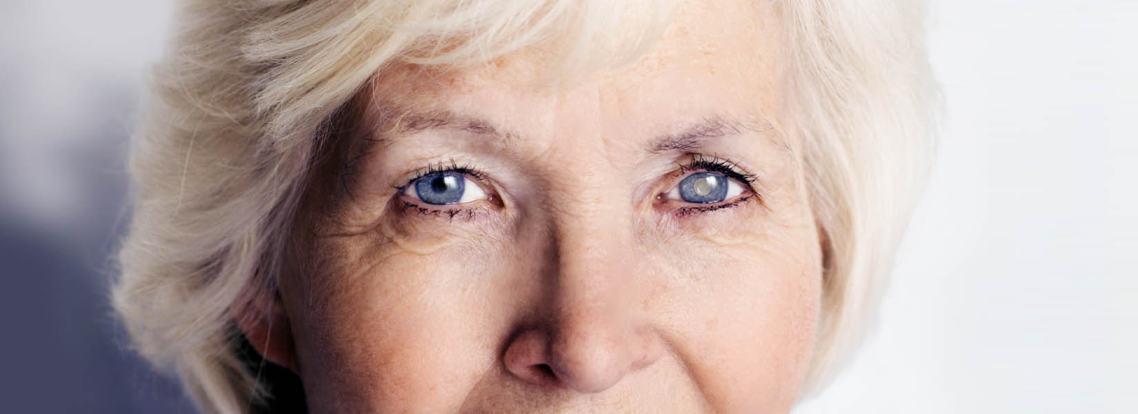 Cataract Surgery in Midtown